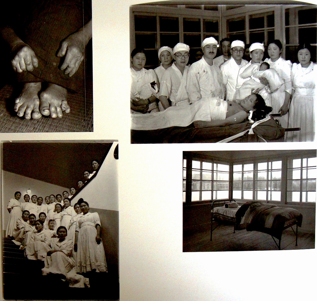 「佐渡万華鏡」161－ABCD 昭和 <br>10年　最新設備を整えた佐渡病院は、昭和10年10月21日から診療